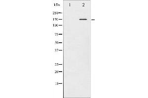 Western blot analysis of Met phosphorylation expression in HepG2 whole cell lysates,The lane on the left is treated with the antigen-specific peptide. (c-MET 抗体  (pTyr1349))