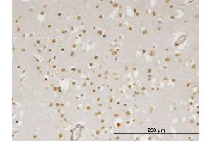 Immunoperoxidase of monoclonal antibody to ZIC4 on formalin-fixed paraffin-embedded human cerebral cortex. (ZIC4 抗体  (AA 1-90))