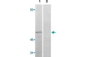 Western blot analysis of Lane 1: COLO205 cells Lane 2: antigen-specific peptide treated COLO205 cells with STK39 (phospho S309) polyclonal antibody . (STK39 抗体  (pSer309))