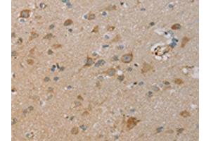 The image on the left is immunohistochemistry of paraffin-embedded Human brain tissue using ABIN7130528(PAGE2 Antibody) at dilution 1/20, on the right is treated with fusion protein. (PAGE2 抗体)
