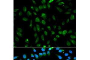 Immunofluorescence analysis of MCF-7 cells using PSMA3 Polyclonal Antibody (PSMA3 抗体)