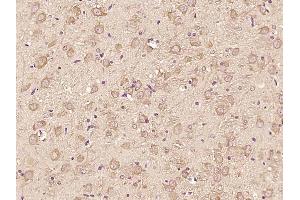 Paraformaldehyde-fixed, paraffin embedded rat brain; Antigen retrieval by boiling in sodium citrate buffer (pH6) for 15min; Block endogenous peroxidase by 3% hydrogen peroxide for 30 minutes; Blocking buffer (normal goat serum) at 37°C for 20min; Antibody incubation with ATF6 Polyclonal Antibody, Unconjugated (bs-23094R) at 1:200 overnight at 4°C, followed by a conjugated secondary and DAB staining. (ATF6 抗体  (AA 431-530))