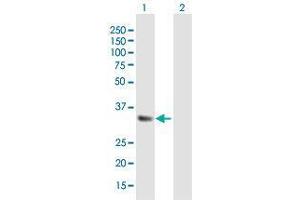 Western Blot analysis of IGFBP5 expression in transfected 293T cell line by IGFBP5 MaxPab polyclonal antibody. (IGFBP5 抗体  (AA 1-272))
