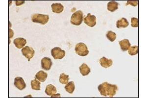 Immunocytochemistry staining of Daudi cells using AP30753PU-N at 2 μg/ml. (SARM1 抗体  (C-Term))