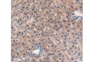 Used in DAB staining on fromalin fixed paraffin- embedded liver tissue (IL-25 抗体  (AA 33-169))