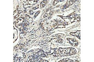 IHC analysis of CCN1/CYR61 using anti-CCN1/CYR61 antibody (ABIN3042351).