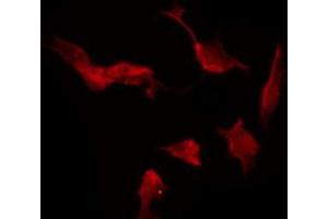 ABIN6272359 staining Hela by IF/ICC. (Neurexin 1 抗体  (N-Term))