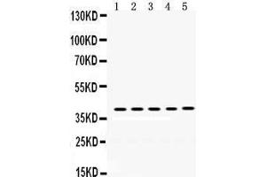 Western Blotting (WB) image for anti-Oncostatin M (OSM) (AA 26-220) antibody (ABIN3043458) (Oncostatin M 抗体  (AA 26-220))