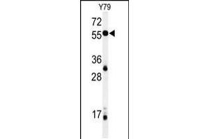 Western blot analysis of NOB1 Antibody in Y79 cell line lysates (35ug/lane) (NOB1 抗体  (C-Term))