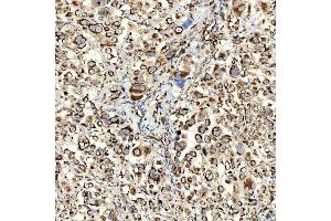 IHC analysis of NLRX1 using anti-NLRX1 antibody (ABIN7602716).
