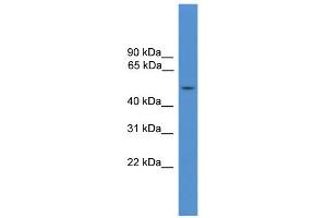 WB Suggested Anti-IL7R Antibody Titration: 0. (IL7R 抗体  (Middle Region))