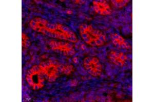 Immunofluorescence of paraffin embedded mouse uterus using Tuba3a (ABIN7076051) at dilution of 1: 600 (450x lens) (Tuba3a 抗体)