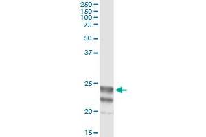 Immunoprecipitation of NAAA transfected lysate using anti-NAAA monoclonal antibody and Protein A Magnetic Bead , and immunoblotted with NAAA MaxPab rabbit polyclonal antibody. (NAAA 抗体  (AA 36-104))