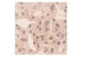Image no. 1 for anti-Chemokine (C-X-C Motif) Ligand 10 (CXCL10) antibody (ABIN791563) (CXCL10 抗体)