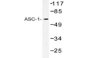 Western blot (WB) analysis of ASC-1 antibody in extracts from K562 cells. (TRIP4 抗体)