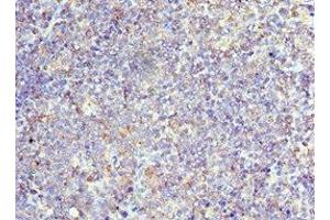 Immunohistochemistry of paraffin-embedded human tonsil tissue using ABIN7171339 at dilution of 1:100 (CD6 抗体  (AA 424-668))