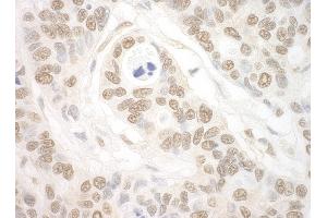 anti-Importin 7 (IPO7) (AA 50-100) antibody