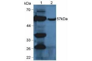 Western blot analysis of (1) Mouse Liver Tissue and (2) Mouse Liver Tissue. (CYP2E1 抗体  (AA 34-273))