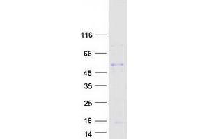 Validation with Western Blot
