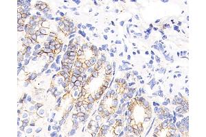 Immunohistochemistry analysis of paraffin-embedded mouse stomach using Catenin beta Monoclonal Antibody at dilution of 1:200. (beta Catenin 抗体)