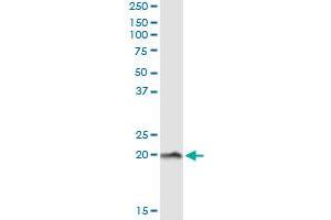 Immunoprecipitation of NPC2 transfected lysate using anti-NPC2 monoclonal antibody and Protein A Magnetic Bead , and immunoblotted with NPC2 MaxPab rabbit polyclonal antibody.