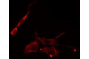 ABIN6274832 staining COLO205 cells by IF/ICC. (ACER3 抗体  (Internal Region))
