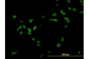 Immunofluorescence of monoclonal antibody to RCC1 on HeLa cell. (RCC1 抗体  (AA 312-421))