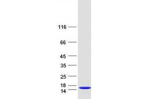 Validation with Western Blot