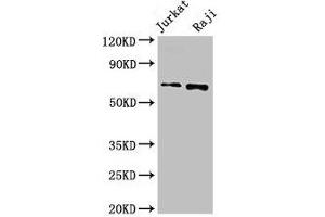 Western Blot Positive WB detected in: Jurkat whole cell lysate, Raji whole cell lysate All lanes: CDC6 antibody at 2. (CDC6 抗体  (AA 1-141))