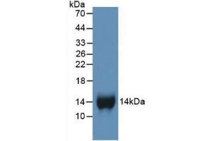Detection of Recombinant bTG, Human using Monoclonal Antibody to Chemokine (C-X-C motif) ligand 7 ( CXCL7) (CXCL7 抗体  (AA 59-128))