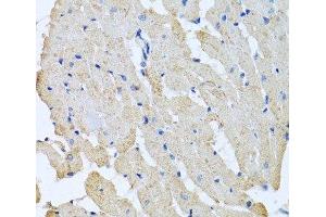 Immunohistochemistry of paraffin-embedded Rat heart using GPLD1 Polyclonal Antibody at dilution of 1:100 (40x lens). (GPLD1 抗体)