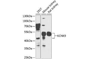 Western blot analysis of extracts of various cell lines, using KCNK9 antibody  at 1:1000 dilution. (KCNK9 抗体  (AA 1-100))