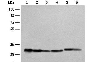 Western blot analysis of Human heart tissue A549 231 Jurkat HEPG2 and Hela cell lysates using ATP5C1 Polyclonal Antibody at dilution of 1:1000 (ATP5C1 抗体)