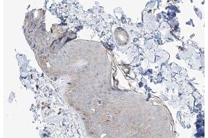 ABIN6266983 at 1/100 staining human skin tissue sections by IHC-P. (MAST4 抗体  (N-Term))