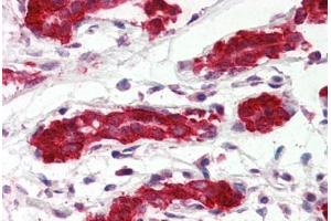 Human Breast (formalin-fixed, paraffin-embedded) stained with PDCD4 antibody ABIN364343 at 5 ug/ml followed by biotinylated anti-mouse IgG secondary antibody ABIN481714, alkaline phosphatase-streptavidin and chromogen. (PDCD4 抗体  (AA 1-469))