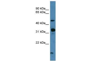 WB Suggested Anti-NPFFR2 Antibody Titration: 0. (NPFFR2 抗体  (C-Term))