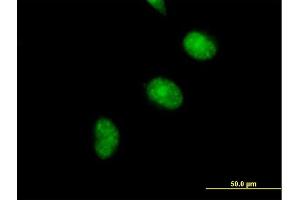 Immunofluorescence of purified MaxPab antibody to CDCA5 on HeLa cell. (CDCA5 抗体  (AA 1-252))
