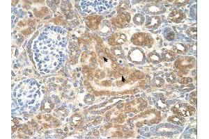 SPTLC1 antibody was used for immunohistochemistry at a concentration of 4-8 ug/ml. (SPTLC1 抗体  (Middle Region))