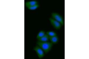 Detection of S100A6 in Human MCF7 cell using Polyclonal Antibody to S100 Calcium Binding Protein A6 (S100A6) (S100A6 抗体  (AA 1-90))