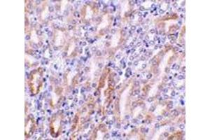 Immunohistochemistry of CAD in mouse kidney tissue with CAD antibody at 1 μg/ml. (DFFB 抗体  (C-Term))