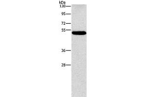 Western Blot analysis of Human lung cancer tissue using CALCRL Polyclonal Antibody at dilution of 1:550 (CALCRL 抗体)