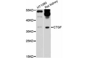 Western blot analysis of extracts of various cell lines, using CTGF antibody. (CTGF 抗体)