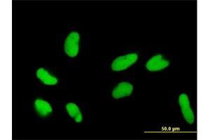 Immunofluorescence of purified MaxPab antibody to DR1 on HeLa cell. (DR1 抗体  (AA 1-176))