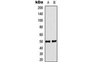 Western blot analysis of IDOL expression in MCF7 (A), mouse heart (B) whole cell lysates. (MYLIP 抗体  (Center))
