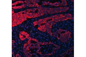 IF analysis of RPL36 using anti-RPL36 antibody (ABIN7602917).