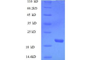 SDS-PAGE (SDS) image for Adrenomedullin (ADM) (AA 45-92) protein (His-SUMO Tag) (ABIN7539980)