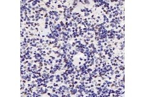 Immunohistochemistry analysis of paraffin-embedded mouse spleen using ADRA1B (ABIN7072974) at dilution of 1: 1200