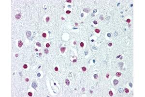 Anti-WHSC1 / NSD2 antibody IHC of human brain, cortex. (WHSC1 抗体  (AA 219-268))
