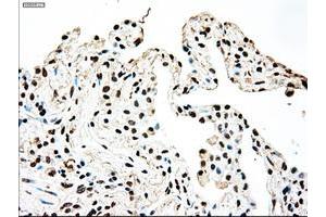 Image no. 13 for anti-Sjogren Syndrome Antigen B (SSB) antibody (ABIN1501146)