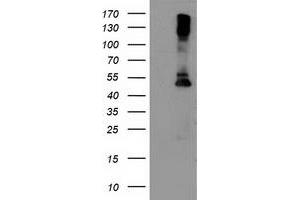 Western Blotting (WB) image for anti-Lipoprotein Lipase (LPL) (AA 28-475) antibody (ABIN1491318) (Lipoprotein Lipase 抗体  (AA 28-475))